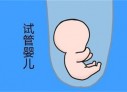 培养重庆捐卵宝宝艺术细胞的小技巧